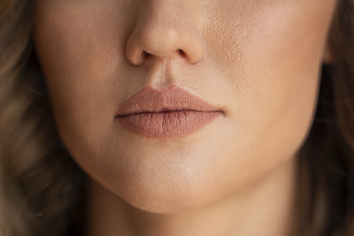 Todo lo que debes saber sobre el aumento de labios con acido hialuronico