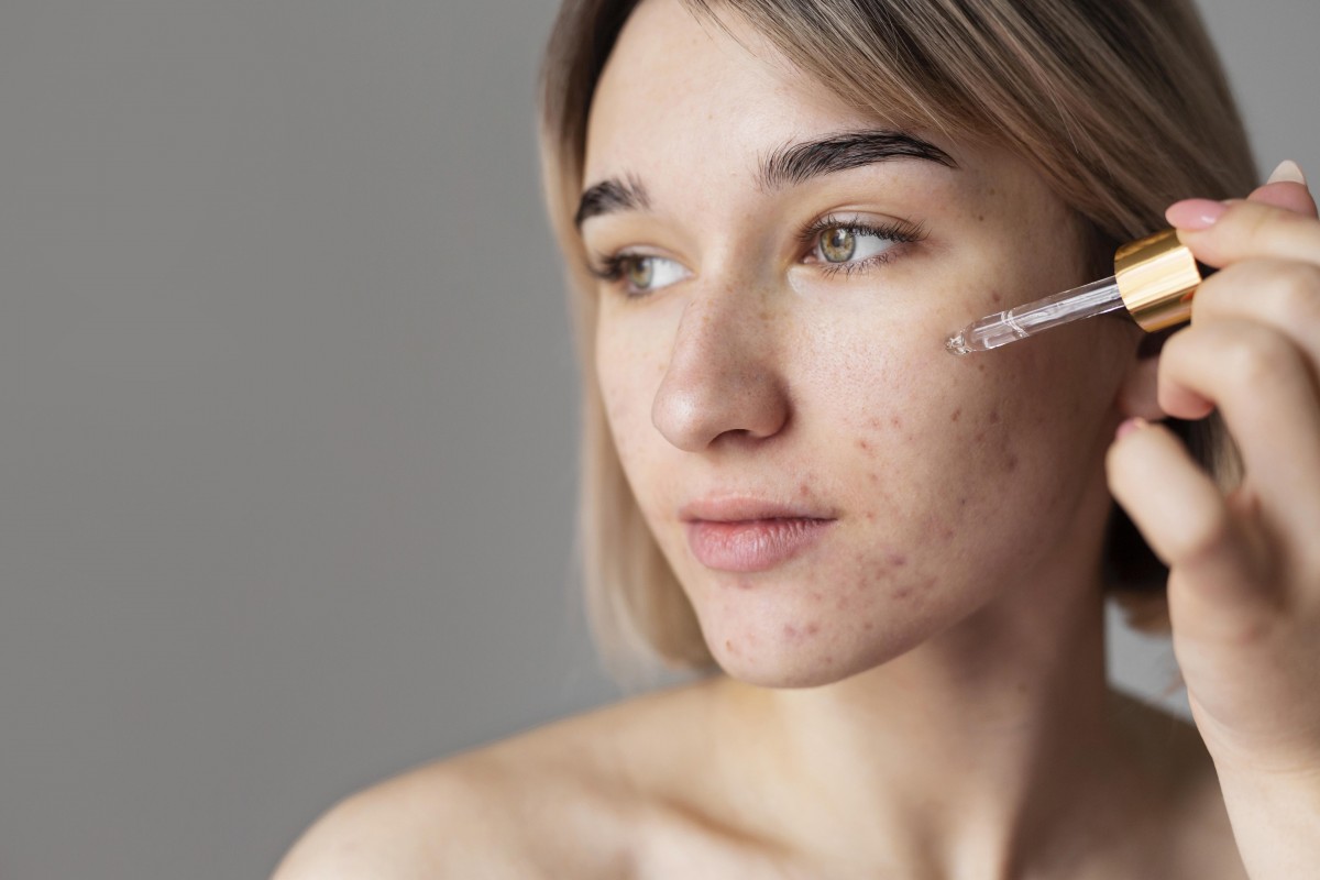 Tres pasos para evitar las manchas faciales