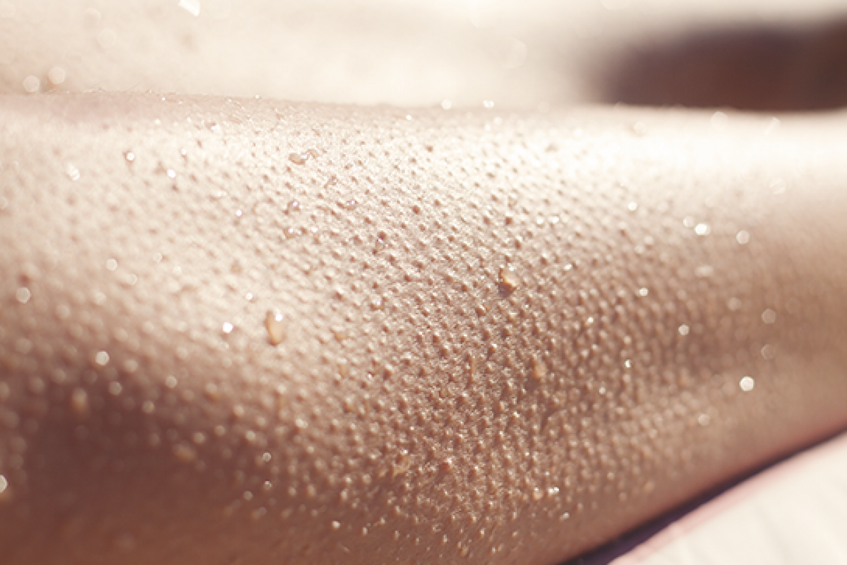 Tratamiento para la Queratosis Pilaris
