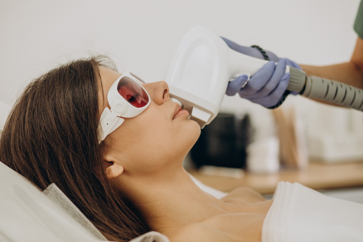 ¿Cómo evitar los efectos secundarios del IPL Facial?